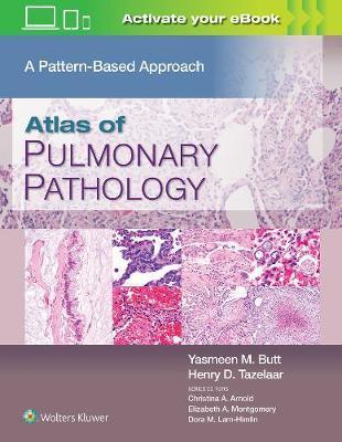 Atlas of Pulmonary Pathology : A Pattern Based Approach                                                                                               <br><span class="capt-avtor"> By:Butt, Yasmeen Mahmood                             </span><br><span class="capt-pari"> Eur:232,50 Мкд:14299</span>
